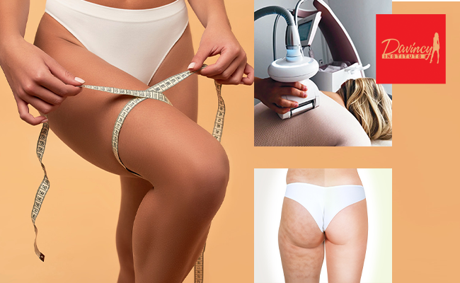 Soin anti-cellulite (1h20)