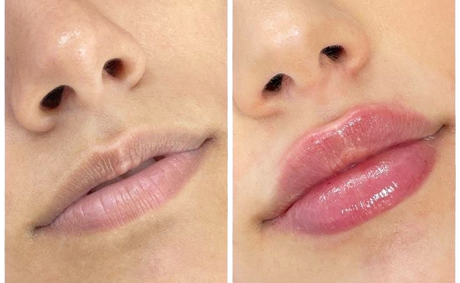  Maquillage semi-permanent candylips