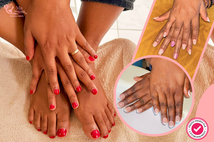 Une pose de  VSP mains et pieds