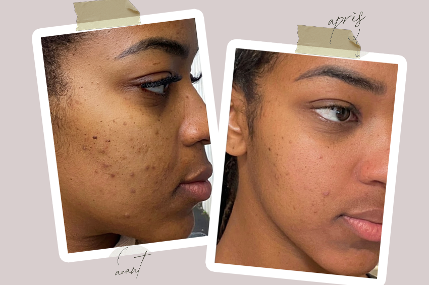 Peeling aux algues marins avec expertise (1h20)